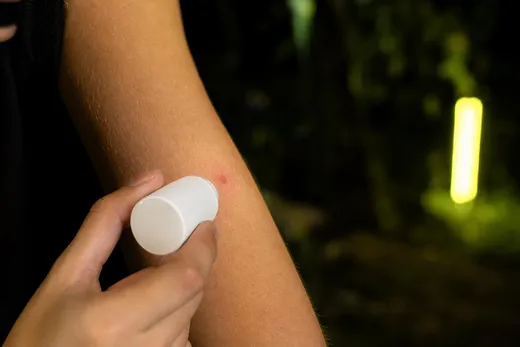 TOP 5 des astuces pour soulager une piqûre de moustique qui gratte sans arrêt